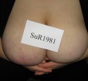 SuR1981